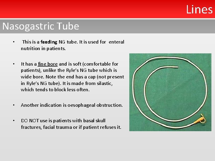 Lines Nasogastric Tube • This is a feeding NG tube. It is used for