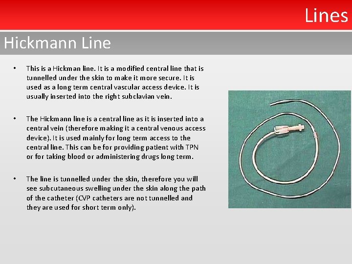 Lines Hickmann Line • • • This is a Hickman line. It is a