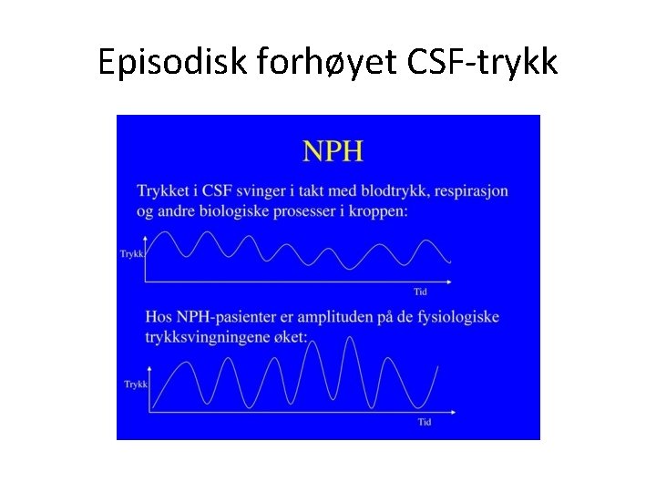 Episodisk forhøyet CSF-trykk 