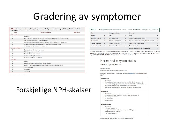 Gradering av symptomer Forskjellige NPH-skalaer 