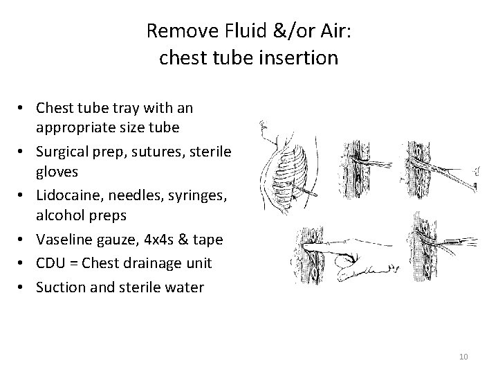 Remove Fluid &/or Air: chest tube insertion • Chest tube tray with an appropriate