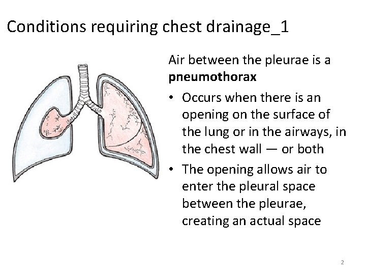 Conditions requiring chest drainage_1 Air between the pleurae is a pneumothorax • Occurs when