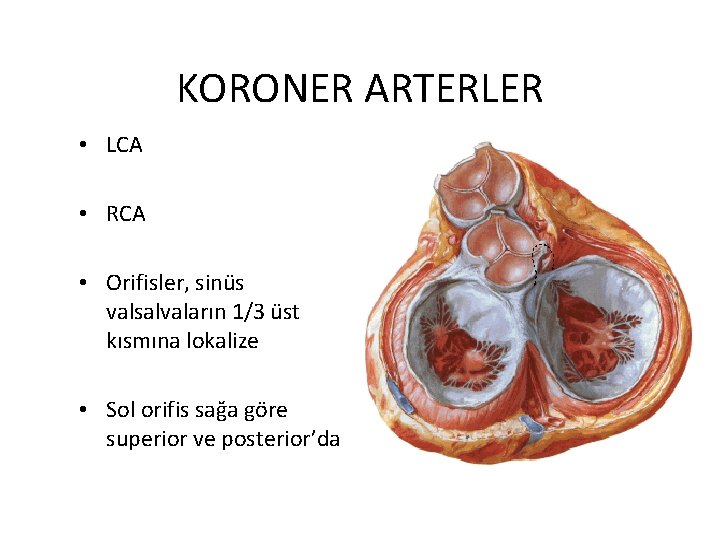 KORONER ARTERLER • LCA • RCA • Orifisler, sinüs valsalvaların 1/3 üst kısmına lokalize