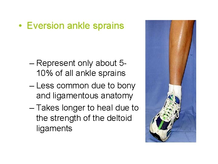  • Eversion ankle sprains – Represent only about 510% of all ankle sprains