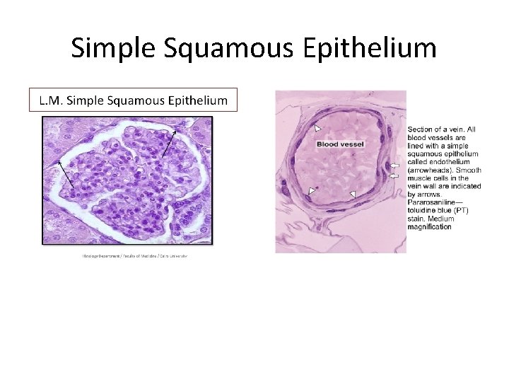 Simple Squamous Epithelium 