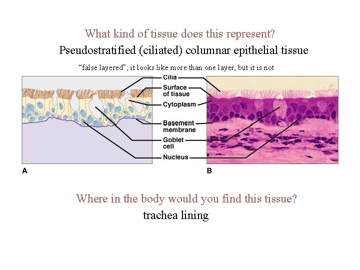 What kind of tissue does this represent? Pseudostratified (ciliated) columnar epithelial tissue “false layered”;