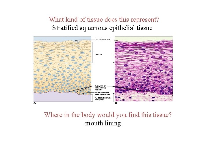 What kind of tissue does this represent? Stratified squamous epithelial tissue Where in the