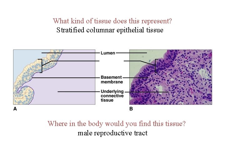 What kind of tissue does this represent? Stratified columnar epithelial tissue Where in the