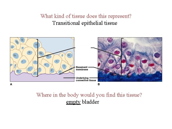 What kind of tissue does this represent? Transitional epithelial tissue Where in the body