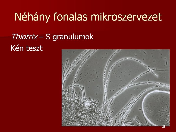 Néhány fonalas mikroszervezet Thiotrix – S granulumok Kén teszt 23 