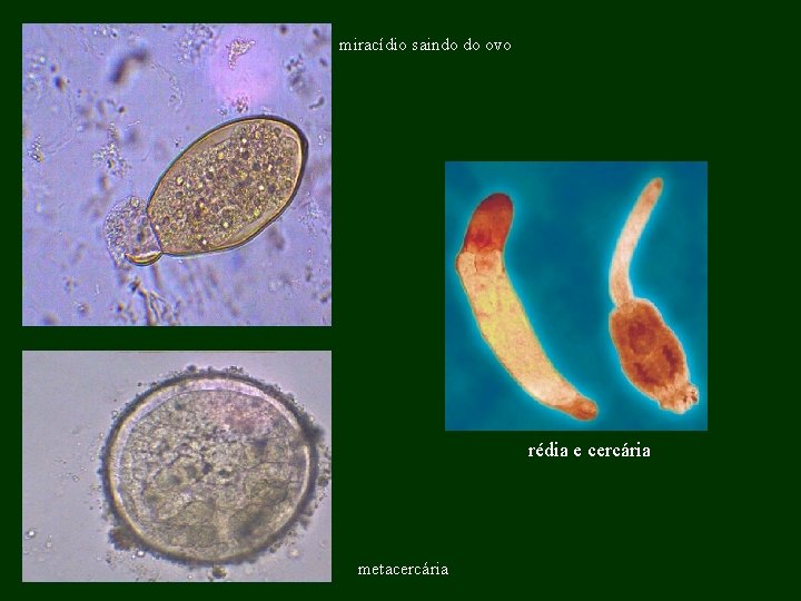 miracídio saindo do ovo rédia e cercária metacercária 