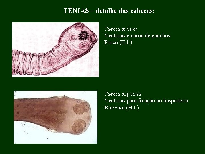 TÊNIAS – detalhe das cabeças: Taenia solium Ventosas e coroa de ganchos Porco (H.