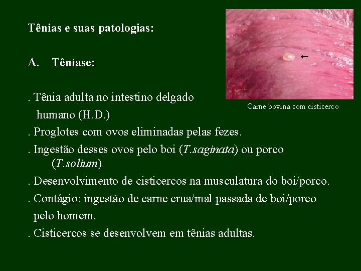 Tênias e suas patologias: A. Têníase: . Tênia adulta no intestino delgado Carne bovina