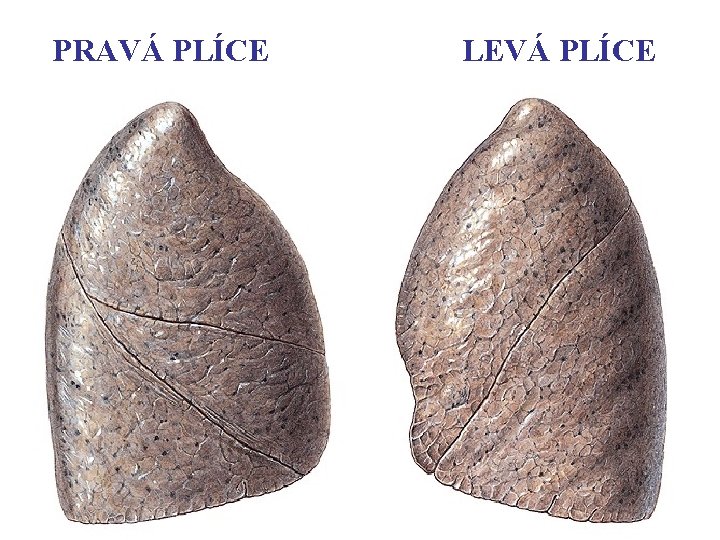 PRAVÁ PLÍCE LEVÁ PLÍCE PRAVÁ PLÍCE LEVÁ PLÍCE