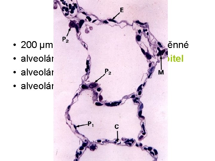 Plicní sklípky Alveoli pulmonis • • 200 μm velké, polyedrické, tenkostěnné alveolární výstelka = Plicní sklípky Alveoli pulmonis • • 200 μm velké, polyedrické, tenkostěnné alveolární výstelka =