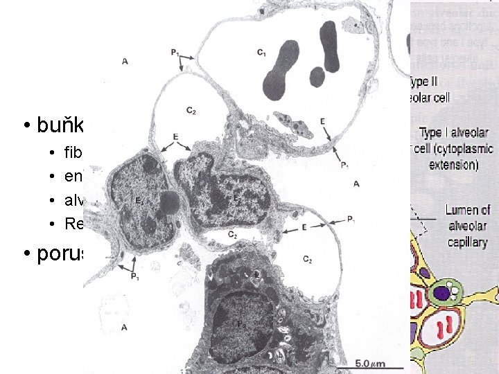 Septum interalveolare Sklípková přepážka • buňky • • fibroblasty (kolagen I. a III. typu) Septum interalveolare Sklípková přepážka • buňky • • fibroblasty (kolagen I. a III. typu)