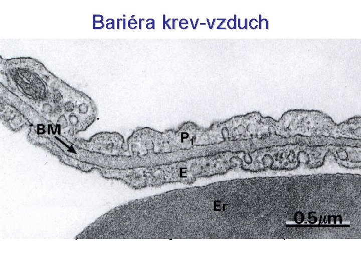 Bariéra krev-vzduch (Claustrum aerosanguineum) • lamina pneumocytica – pneumocyty I. typu • lamina basalis Bariéra krev-vzduch (Claustrum aerosanguineum) • lamina pneumocytica – pneumocyty I. typu • lamina basalis