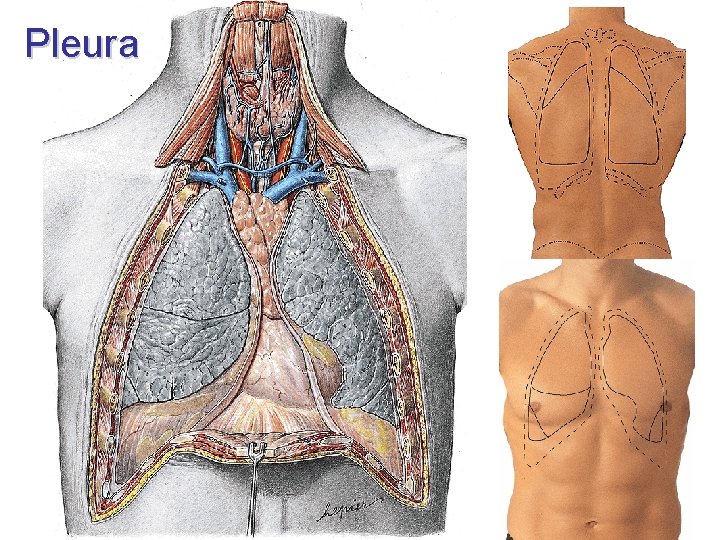 Pleura Pleura