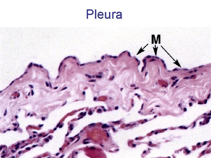 Pleura Pleura