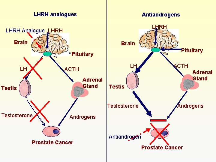 LHRH analogues Antiandrogens LHRH Analogue LHRH Brain Pituitary LH LH ACTH Adrenal Gland Testis