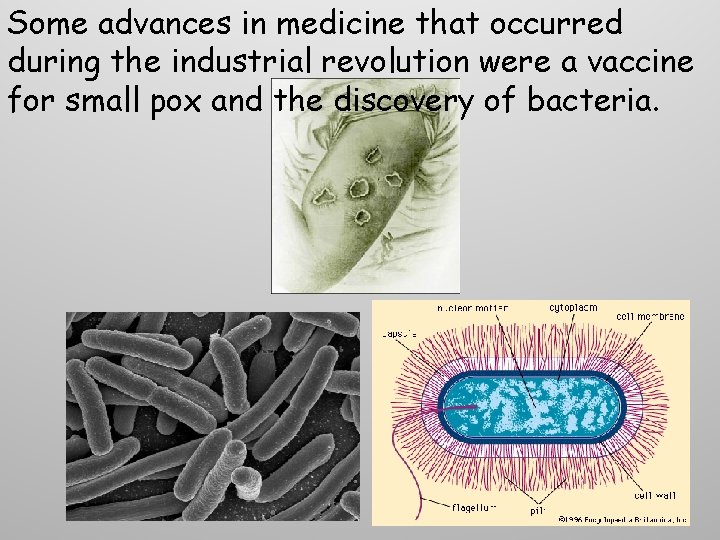 Some advances in medicine that occurred during the industrial revolution were a vaccine for Some advances in medicine that occurred during the industrial revolution were a vaccine for