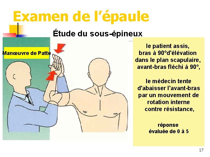 Examen de l’épaule Étude du sous-épineux Manœuvre de Patte le patient assis, bras à