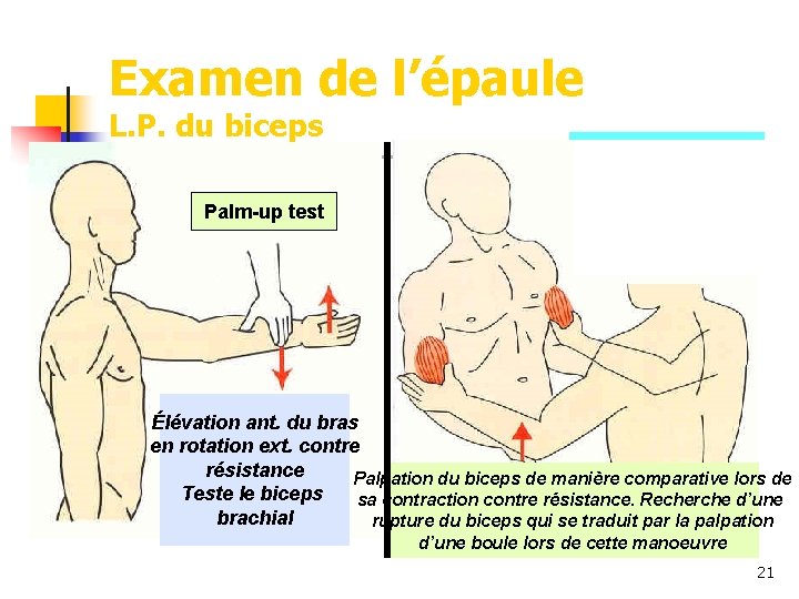 Examen de l’épaule L. P. du biceps Palm-up test Élévation ant. du bras en