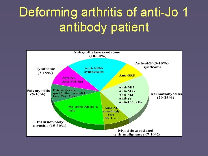 Deforming arthritis of anti-Jo 1 antibody patient 