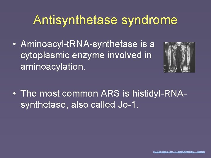 Antisynthetase syndrome • Aminoacyl-t. RNA-synthetase is a cytoplasmic enzyme involved in aminoacylation. • The