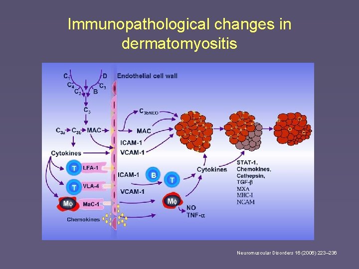 Immunopathological changes in dermatomyositis Neuromuscular Disorders 16 (2006) 223– 236 