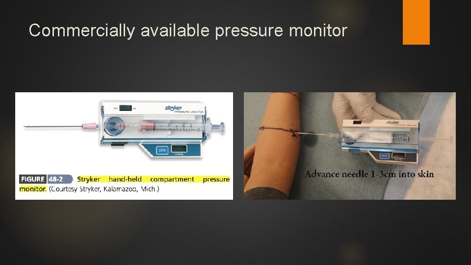 Commercially available pressure monitor 