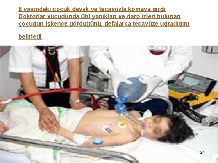 8 yaşındaki çocuk dayak ve tecavüzle komaya girdi Doktorlar vücudunda ütü yanıkları ve darp