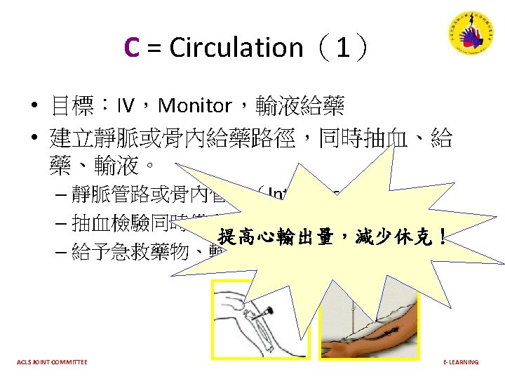 Primary Abcd Survey A B C D Acls