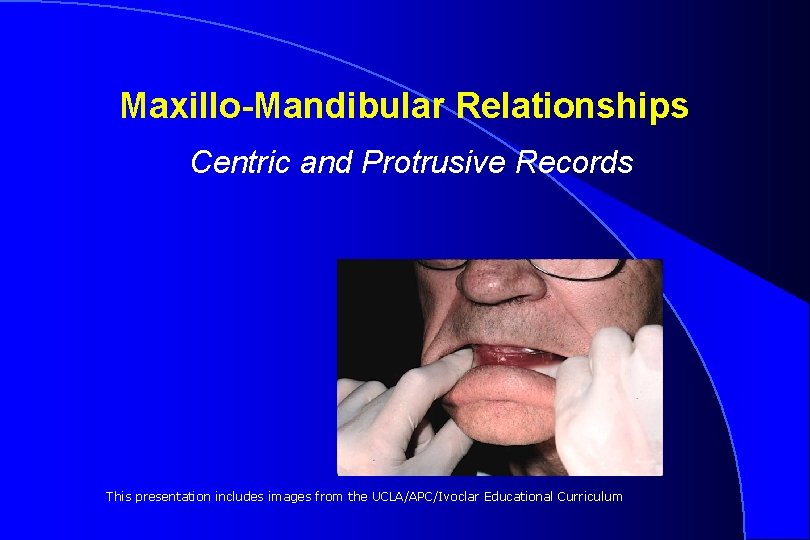 Maxillo-Mandibular Relationships Centric and Protrusive Records This presentation includes images from the UCLA/APC/Ivoclar Educational