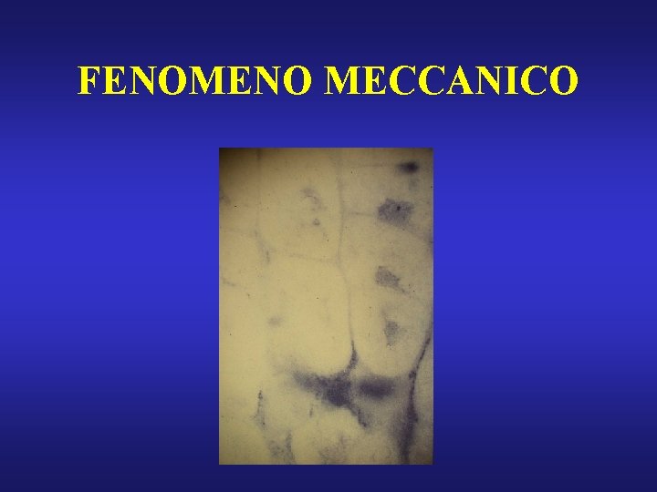 FENOMENO MECCANICO 