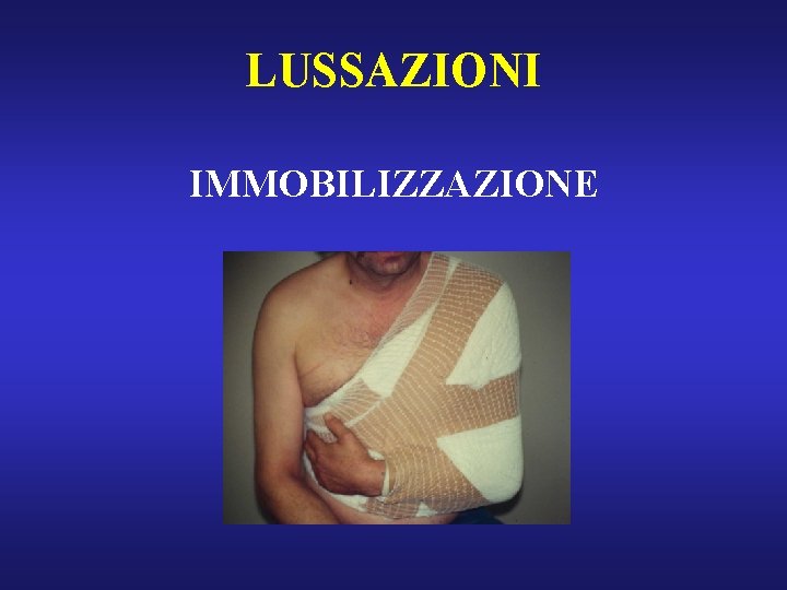 LUSSAZIONI IMMOBILIZZAZIONE 