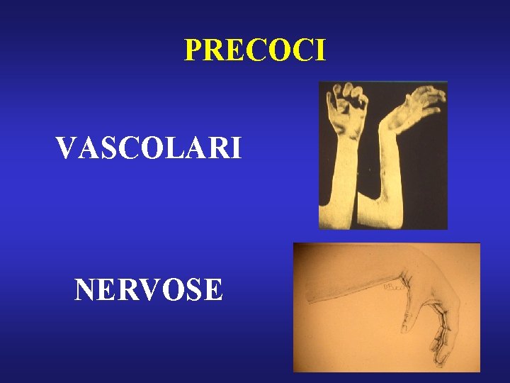 PRECOCI VASCOLARI NERVOSE 