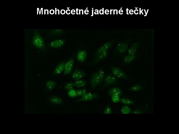 Mnohočetné jaderné tečky 