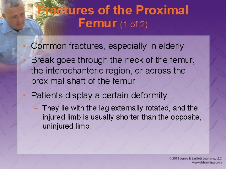 Fractures of the Proximal Femur (1 of 2) • Common fractures, especially in elderly