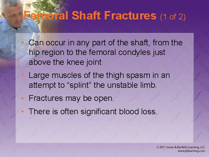 Femoral Shaft Fractures (1 of 2) • Can occur in any part of the
