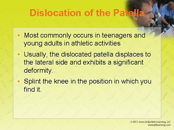 Dislocation of the Patella • Most commonly occurs in teenagers and young adults in