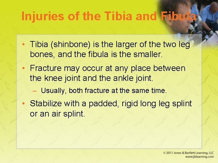 Injuries of the Tibia and Fibula • Tibia (shinbone) is the larger of the
