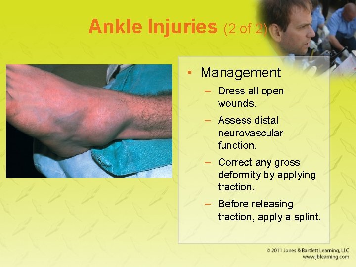 Ankle Injuries (2 of 2) • Management – Dress all open wounds. – Assess