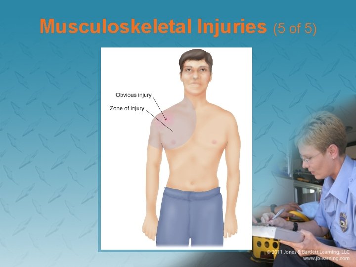 Musculoskeletal Injuries (5 of 5) 