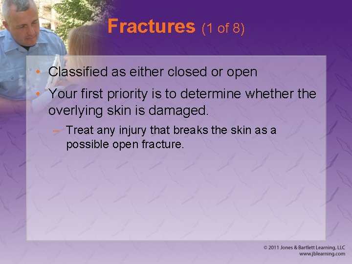 Fractures (1 of 8) • Classified as either closed or open • Your first