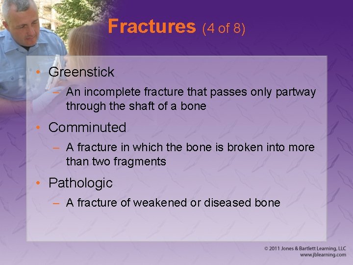 Fractures (4 of 8) • Greenstick – An incomplete fracture that passes only partway