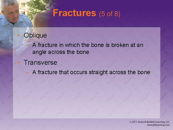 Fractures (5 of 8) • Oblique – A fracture in which the bone is
