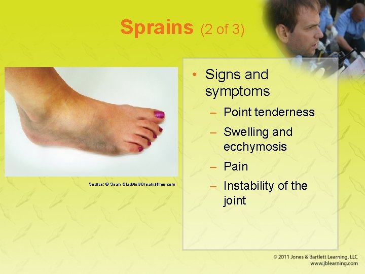 Sprains (2 of 3) • Signs and symptoms – Point tenderness – Swelling and