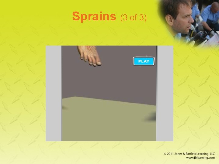 Sprains (3 of 3) 