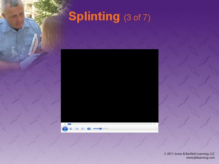 Splinting (3 of 7) 